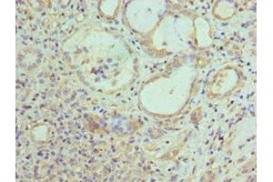 Immunohistochemistry of paraffin-embedded human kidney tissue using ABIN7157845 at dilution of 1:100 (EPM2A Antikörper  (AA 244-331))