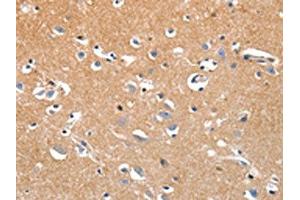 The image on the left is immunohistochemistry of paraffin-embedded Human brain tissue using ABIN7191320(LRP3 Antibody) at dilution 1/80, on the right is treated with synthetic peptide.