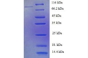 SDS-PAGE (SDS) image for Protein-tyrosine Phosphatase 1C (PTPN6) (AA 1-597), (Isoform 2) protein (His-SUMO Tag) (ABIN5710185) (SHP1 Protein (AA 1-597, Isoform 2) (His-SUMO Tag))