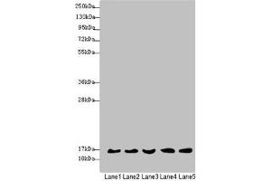 Western blot All lanes: MRPS16 antibody at 1. (MRPS16 Antikörper  (AA 1-137))