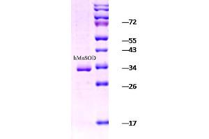 SDS-PAGE of 25 kDa human Mn SOD (ABIN1686711, ABIN1686712 and ABIN1686713). (SOD2 Protein (His tag))