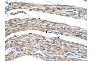 SLC17A4 antibody was used for immunohistochemistry at a concentration of 4-8 ug/ml to stain Skeletal muscle cells (arrows) in Human Muscle. (SLC17A4 Antikörper)