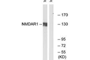 Western Blotting (WB) image for anti-Glutamate Receptor, Ionotropic, N-Methyl D-Aspartate 1 (GRIN1) (AA 856-905) antibody (ABIN2888740) (GRIN1/NMDAR1 Antikörper  (AA 856-905))