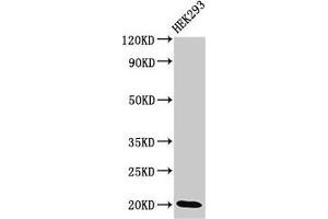 Western Blot Positive WB detected in: HEK293 whole cell lysate All lanes: DLX6 antibody at 3. (DLX6 Antikörper  (AA 110-171))