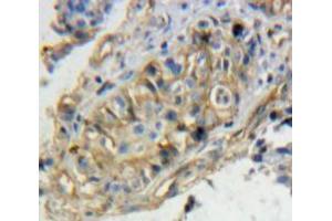 Used in DAB staining on fromalin fixed paraffin-embedded Ovary tissue (TPBG Antikörper  (AA 34-356))