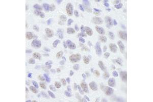 Immunohistochemistry (IHC) image for anti-Scaffold Attachment Factor B (SAFB) (C-Term) antibody (ABIN7448784) (SAFB Antikörper  (C-Term))
