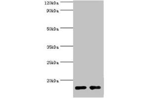 Western blot All lanes: Gastrotropin antibody at 8 μg/mL Lane 1: Mouse small intestine tissue Lane 2: Rat small intestine tissue Secondary Goat polyclonal to rabbit IgG at 1/10000 dilution Predicted band size: 15, 20 kDa Observed band size: 15 kDa (FABP6 Antikörper  (AA 1-128))