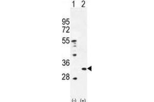 Western Blotting (WB) image for anti-Peroxiredoxin 4 (PRDX4) antibody (ABIN2996535) (Peroxiredoxin 4 Antikörper)