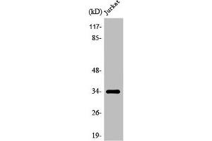 Western Blot analysis of COLO205 cells using Olfactory receptor 8D1 Polyclonal Antibody (OR8D1 Antikörper  (C-Term))