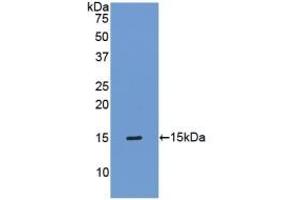 Detection of Recombinant TIMP1, Mouse using Polyclonal Antibody to Tissue Inhibitors Of Metalloproteinase 1 (TIMP1) (TIMP1 Antikörper  (AA 35-160))