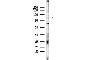 Western blot analysis of lysates from F10-LUC cells(heat-shock,45 min treatment), using KIF2C Antibody at 1/1000 dilution.