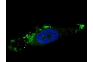 Fluorescent image of chloroquine-treated U251 cells stained with ATG12 antibody. (ATG12 Antikörper  (AA 1-30))