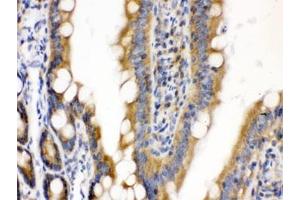 IHC testing of FFPE rat intestine with CDCP1 antibody. (CDCP1 Antikörper)
