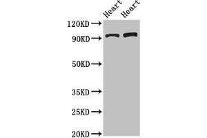 Western Blot Positive WB detected in: Rat heart tissue, Mouse heart tissue All lanes: GPAM antibody at 3. (GPAM Antikörper  (AA 281-459))