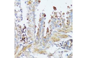 Immunohistochemistry (IHC) image for anti-Wingless-Type MMTV Integration Site Family, Member 1 (WNT1) (AA 231-370) antibody (ABIN1683291)