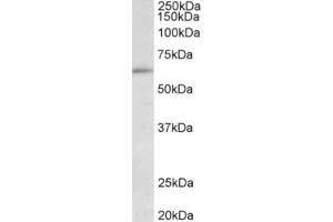 Western Blotting (WB) image for anti-Hypermethylated in Cancer 2 (HIC2) (Internal Region) antibody (ABIN2465146) (HIC2 Antikörper  (Internal Region))