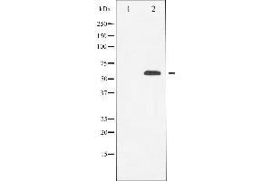 Western blot analysis of RUNX2 expression in HeLa cells,The lane on the left is treated with the antigen-specific peptide. (RUNX2 Antikörper  (Internal Region))