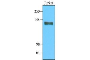 Cell lysates of Jurkat(20 ug) were resolved by SDS-PAGE, transferred to nitrocellulose membrane and probed with anti-human CD45 (1:2000). (CD45 Antikörper  (AA 1029-1249))