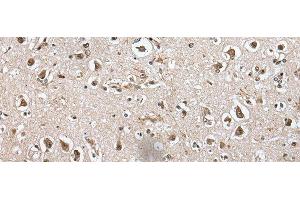 Immunohistochemistry (Paraffin-embedded Sections) (IHC (p)) image for anti-Methionyl Aminopeptidase Type 1D (Mitochondrial) (METAP1D) antibody (ABIN7252066)