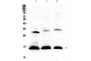 Western blot analysis of HBD using anti-HBD antibody .