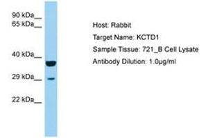Image no. 1 for anti-Potassium Channel Tetramerisation Domain Containing 1 (KCTD1) (AA 110-159) antibody (ABIN6750204) (KCTD1 Antikörper  (AA 110-159))