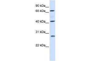 WB Suggested Anti-RDM1 Antibody Titration: 0. (RDM1 Antikörper  (Middle Region))