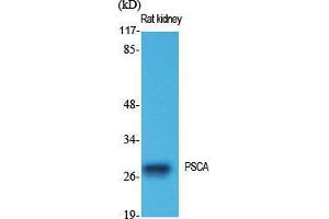 Western Blot (WB) analysis of specific cells using PSCA Polyclonal Antibody.