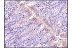 AP20061PU-N PIST antibody staining of Rat Colon tissue by Immunohistochemistry at 1 μg/ml. (GOPC Antikörper  (Middle Region))