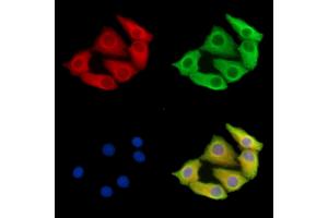 ABIN7095739 and ABIN7099801 staining Hela cells by IF/ICC. (MGAT5 Antikörper)