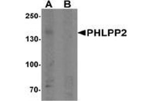 Western blot analysis of PHLPP2 in SW480 cell lysate with PHLPP2 Antibody  at 1 μg/ml in (A) the presence and (B) the absence of blocking peptide. (PHLPP2 Antikörper  (C-Term))