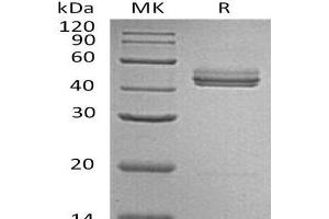 Western Blotting (WB) image for Interleukin 23 (IL23) protein (ABIN7320590) (IL23 Protein)
