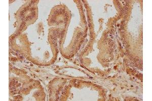 IHC image of ABIN7145007 diluted at 1:300 and staining in paraffin-embedded human prostate tissue performed on a Leica BondTM system. (SUPV3L1 Antikörper  (AA 499-786))
