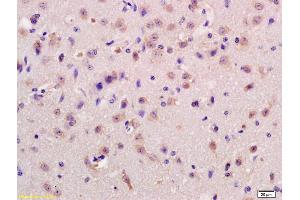 Formalin-fixed and paraffin embedded rat brain labeled with Anti-GPCR GPR37 Polyclonal Antibody, Unconjugated (ABIN1713825) at 1:200 followed by conjugation to the secondary antibody and DAB staining.