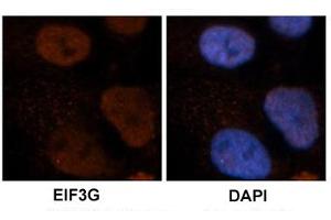 Immunohistochemical staining of human brain stem cells with EIF3G polyclonal antibody .
