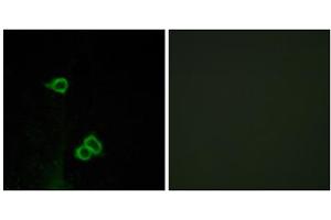 Immunofluorescence analysis of COS-7 cells, using CXCR7 antibody. (CXCR7 Antikörper  (C-Term))