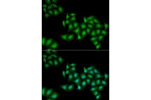 Immunofluorescence analysis of MCF7 cells using DDX1 antibody. (DDX1 Antikörper  (AA 441-740))