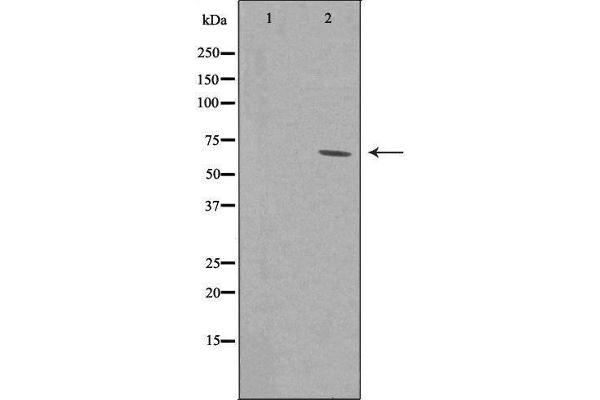 ZNF460 Antikörper  (C-Term)