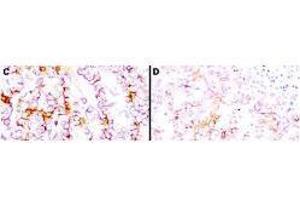 Immunohistochemistry using  anti-mesothelin antibodies to detect mesothelin in PEFF human tissue sections treated by antigen retrieval methods. (Mesothelin Antikörper  (Extracellular, Extracellular Domain))