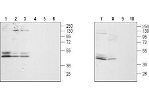 Western blot analysis of rat hippocampus, DRG (lanes 2 and 5), brain (lanes 3 and 6), mouse brain (lanes 7 and 9) and human prostate carcinoma LNCaP cell lysates: - 1,2,3,7,8. (GALR2 Antikörper  (3rd Intracellular Loop))