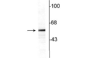Western blot of 10ug of rat striatal lysate showing specific immunolabeling of the ~60 kDa tyrosine hydroxylase protein.