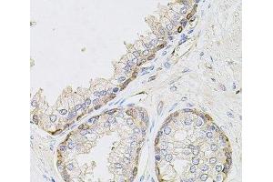 Immunohistochemistry of paraffin-embedded Human prostate using CIB1 Polyclonal Antibody at dilution of 1:100 (40x lens). (CIB1 Antikörper)