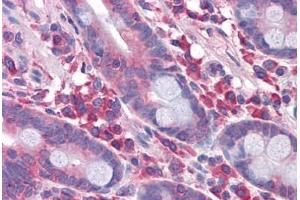 Human Small Intestine: Formalin-Fixed, Paraffin-Embedded (FFPE) (DPF2 Antikörper  (AA 56-155))
