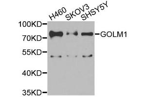 Western blot analysis of extracts of various cell lines, using GOLM1 antibody (ABIN5974385) at 1/1000 dilution. (GOLM1 Antikörper)