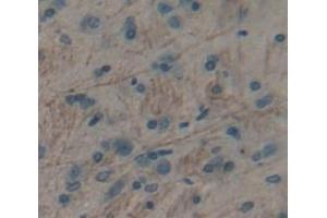 IHC-P analysis of brain tissue, with DAB staining. (TRPM7 Antikörper  (AA 19-179))