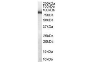 Image no. 2 for anti-Midline 2 (MID2) (C-Term) antibody (ABIN374299) (Midline 2 Antikörper  (C-Term))