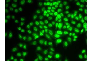 Immunofluorescence analysis of HeLa cells using CCNG1 antibody (ABIN6290270). (Cyclin G1 Antikörper)