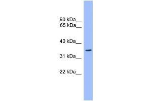 WB Suggested Anti-OR2C3 Antibody Titration: 1. (OR2C3 Antikörper  (C-Term))