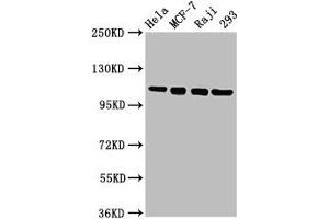 Western Blot Positive WB detected in: Hela whole cell lysate, MCF-7 whole cell lysate, Raji whole cell lysate, 293 whole cell lysate All lanes: MCM2 antibody at 4. (MCM2 Antikörper  (AA 2-904))
