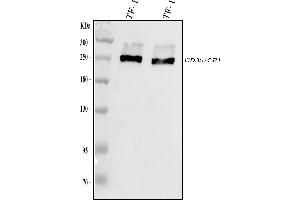 Western blot analysis of CD35 using anti-CD35 antibody (ABIN7599703). (CD35 Antikörper  (AA 109-957))