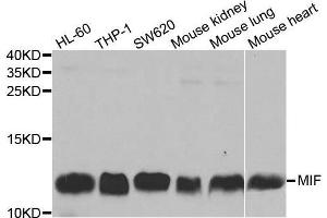 Western blot analysis of extracts of various cell lines, using MIF antibody. (MIF Antikörper  (AA 1-115))